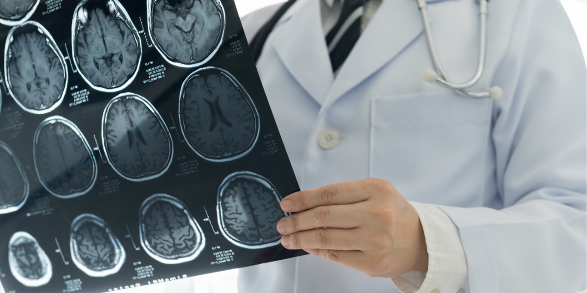 doctor assessing brain mri scans